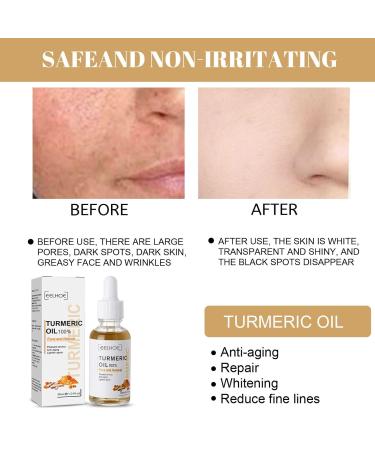 2PCS Turmeric Dark Spot Corrector Serum Oil - Natural Repair & Moisturizing Face & Body Treatment (30ml - Buy Online on GoSupps.com