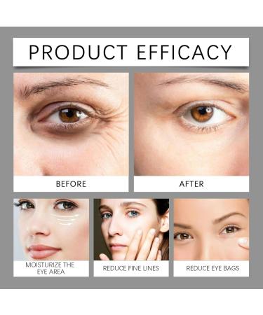 Anti Cerne Sous Les Yeux Homme Castor Oil Castor Eye Serum Oil S rum nergisant Pour Les Cernes Et Les Poches Ridules Rides Roll on Facial Serum with Organic Castor Oil Anti Ride Express (10ml 1PC) 1PC 10 ml (Lot de 1) - Buy Online on GoSupps.com