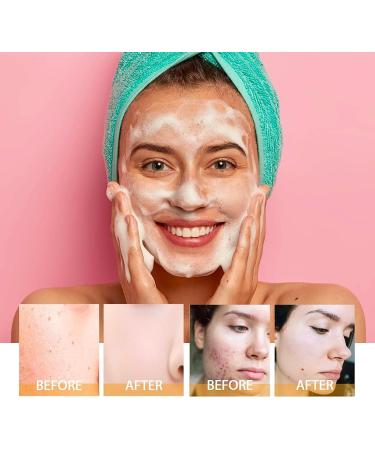 Turmeric Face Wash With Brush Turmeric Kojic Acid Foaming Cleanser Turmeric Cleansing Oil Clean And Clear Cleanser Foaming Face Wash Women For Skin Tone Reduce Blemish & Acne Hydrate Skin Vegan - Buy Online on GoSupps.com