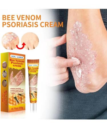 Bee Veno-m Body Cream for Skin Itchiness Smoothing Body Cream for Skin Redness Relieve Skin Itching & Long Lasting Hydration - Buy Online on GoSupps.com