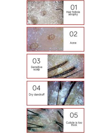 Skin Scalp Detector 13 Inch HD LCD Screen Skin Hair Follicle Detector Skin Hair Scalp Analysis Digital Skin Detector Moisture Tester Rechargeable Hair Follicle Skin Analyser - Buy Online on GoSupps.com