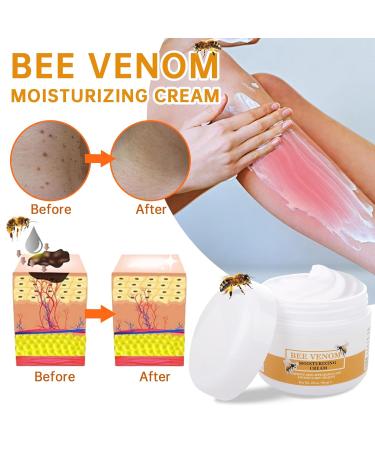 Bee Venom Repair Cream - Moisturizing Skin Treatment for Men & Women | 2 OZ International Shipping - Buy Online on GoSupps.com