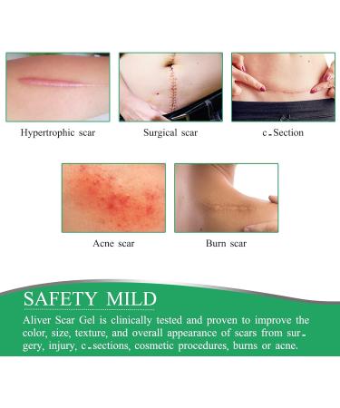 Silicone Scar Sheets 1.6 x 60 - Medical Grade Soft Silicone Tape for Easy Scar Removal - Comfortable & Pain-Free - Buy Online on GoSupps.com