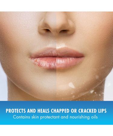 Mentholatum Natural Ice Lip Balm - Cherry  - 0.15 Oz. - Buy Online on GoSupps.com