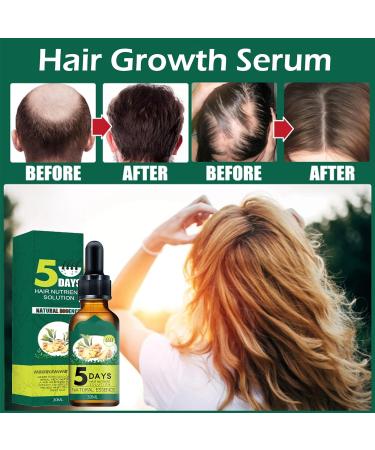 Ginger Hair Growth Set - Anti Hair Loss Shampoo & Serum for Thickening, Nourishing Scalp, Natural Baldness Treatment - Men & Women - 2 Pack (1A+1B) - Buy Online on GoSupps.com