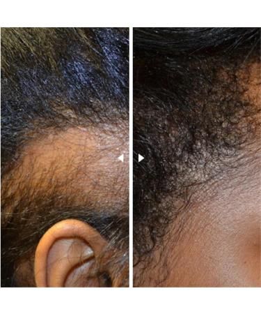 Apr s-shampoing PP405 essence anti-chute absorption rapide non gras unisexe huile de croissance capillaire sans rin age convient tous types de cheveux 1PCS - Buy Online on GoSupps.com