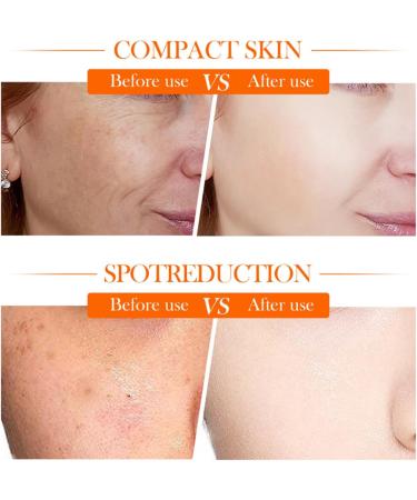  Ziennhu Micellar Water - Purifying Toner - Regulates Sebum Production - Moisturizing Face Cream - Nourishing Face Lotion - Moisturizing Lotion for Dry Skin - Anti-aging Face Lotion - Buy Online on GoSupps.com