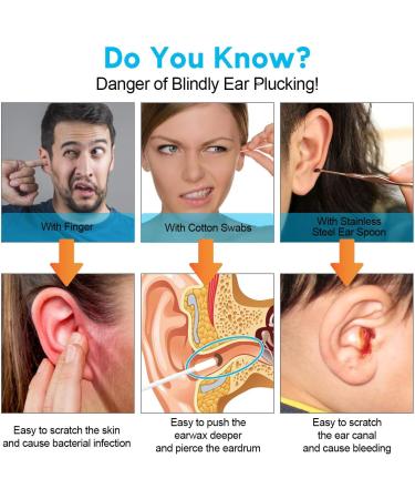 Urbesty Earwax Removal Camera - 1080P HD Wireless Endoscope Kit with Light | Mini Otoscope for Ear Cleaning | Includes Reusable Ear Spoons | Black - Buy Online on GoSupps.com