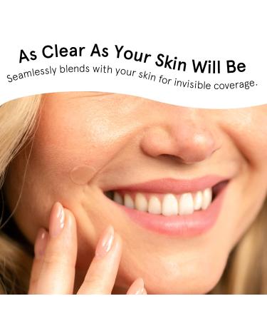 Grace & Stella Pimple Patches for Face - 72 Hydrocolloid Acne Patches | Vegan & Cruelty-Free Blemish Stickers Dermatologist Tested - Buy Online on GoSupps.com