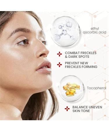 Aobenz Spot Remover For Face Aobenz Spot Remover Serum Aobenz Anti Spot Brightening And Removing Freckles Hyperpigmentation Treatment Spot Remover Serum Face Serum For All Skin Types - Buy Online on GoSupps.com