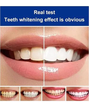 Yayashi Sp-4 Toothpaste Yiliku sp-4 Toothpaste SP-4 Brightening Toothpaste Fresh Breath Toothpaste (Blue*2) - Buy Online on GoSupps.com