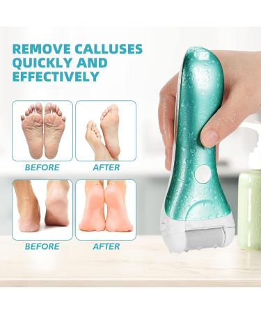 Buy Nicebirdie Electric Callus Remover for Feet - Waterproof Rechargeable Foot File & Pedicure Tool for Cracked Heels - Fast International Shipping - Buy Online on GoSupps.com