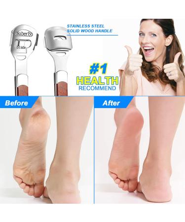 Professional Foot Scraper & Callus Remover | Stainless Steel Pedicure Tool with 20 Replacement Blades - Ultimate Foot Care Solution - Buy Online on GoSupps.com