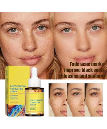 Correcting Face Serum Spot Remover For Face Color Correcting Serum Brightening Serum Face Serums Moisturiser Face Whitening Serum Anti Aging Serum For Face Skincare - Buy Online on GoSupps.com