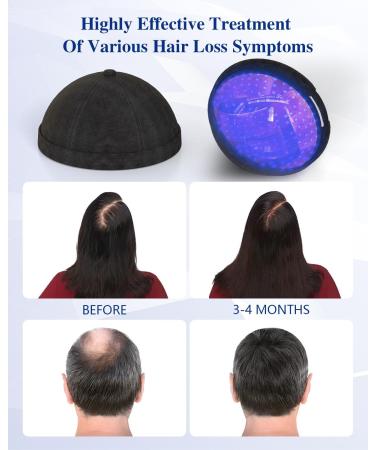 KTS Laser Hair Growth Cap FDA Red Light Therapy Helmet - Anti Hair Loss Treatment for Men & Women - Restores Hair Thickness and Density - Buy Online on GoSupps.com