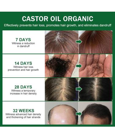 Organic Black Castor Oil for Hair Growth Cold Pressed Castor Oil for Eyelashes and Eyebrows Hair Growth Oil Castor Oil Organic for Damaged Hair Skin Nails Beard Strengthen Hair Roots - Buy Online on GoSupps.com
