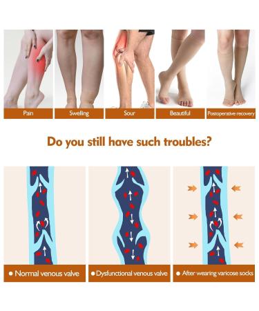 Bounfend Compression Socks 20-30mmHg - Knee High Open Toe Medical Grade Stockings for Men & Women | Varicose Vein Relief Swollen Legs Shin Splints Travel | Beige L Large - Buy Online on GoSupps.com