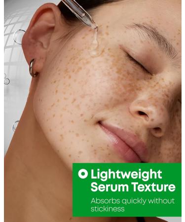 Nineless 10% Azelaic Acid Serum with Niacinamide & Snail Mucin - Redness Relief & Dark Spot Corrector for Face - Facial Serum for Acne-Prone Oil Control & Pore Care 1.01 fl.oz - Buy Online on GoSupps.com