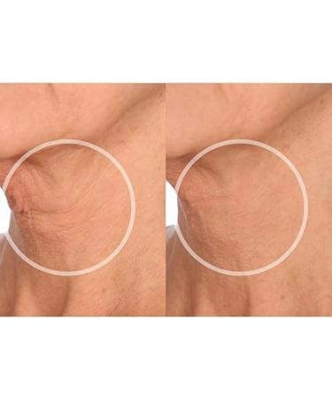 SiO Beauty FaceLift: Overnight Anti-Wrinkle Patches for Neck, Forehead, Eyes & Smile â€“ Smoothing Silicone for Fine Lines & Aging - Buy Online on GoSupps.com