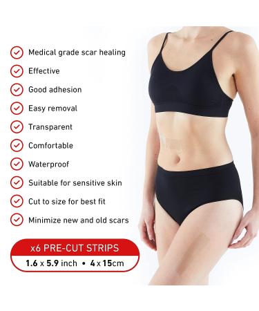 Neo G Opti-Heal Silicone Scar Strips for Surgical, C-Section, Burn, Acne, Keloid Treatment - 6 Strips - 1.6 x 5.9 inch - Medical Grade Scar Sheets - Buy Online on GoSupps.com