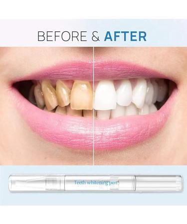 4 Pack Teeth Whitening Pens - Professional Abbey Whitening Essence for Painless Tooth Bleaching & Bright White Smile - Buy Online on GoSupps.com