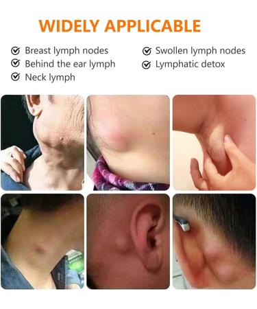 TUITUII Lymph nodes herbal detox cream lymph care ointment lymph drainage massage cream lymph antiswelling herbal ointment massage eliminates lymph enlargement suitable for all skin types 20 g - Buy Online on GoSupps.com