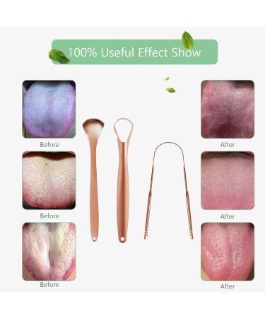 Stainless Steel Tongue Scraper Kit 3-Piece Oral Care Set for Fresh Breath | Tongue Cleaner with Metal Case - Buy Online on GoSupps.com