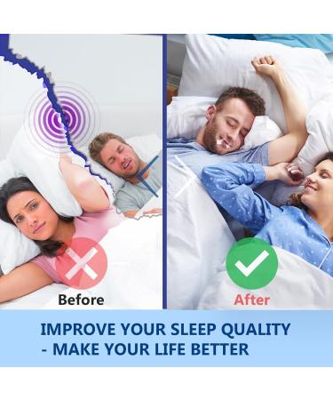 Mouth Tape for Sleeping - 200Pcs Anti Snoring Strips for Improved Nose Breathing - Buy Online on GoSupps.com
