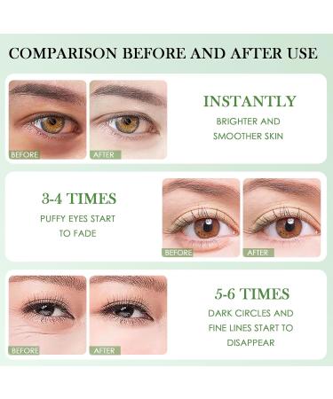 60 Pi ces Patch Yeux Anti Cernes Masque pour les Yeux Aloe Vera Yeux claircir Les Cernes Nourrit et lisse le contour des yeux R duit les Cernes Sous les Yeux - Buy Online on GoSupps.com