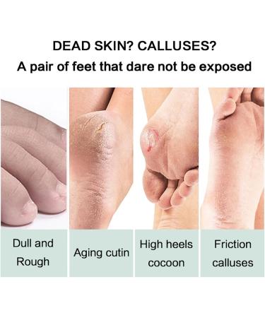 Urea 42% Foot Cream - 120g Cracked Heel Repair Cream - Foot Cream for Very Dry Feet - Foot Cream for Cracked Heels and Dry Skin - Maximum Strength For Hand Foot and Body Care - Buy Online on GoSupps.com