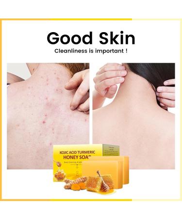 Organic Turmeric Kojic Acid Soap - 200g Brightening Bar for Hyperpigmentation Dark Spots & Acne - 7OZ Natural Hand & Body Wash - Buy Online on GoSupps.com