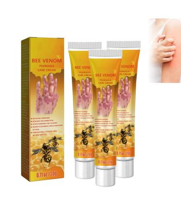 ROKOBN Youth Bee Venom Psoriasis Treatment Cream 20g New Zealand Bee Venom Professional Psoriasis Treatment Cream Soothing Psoriasis Cream Psoriasis Treatment for Skin (3PCS)