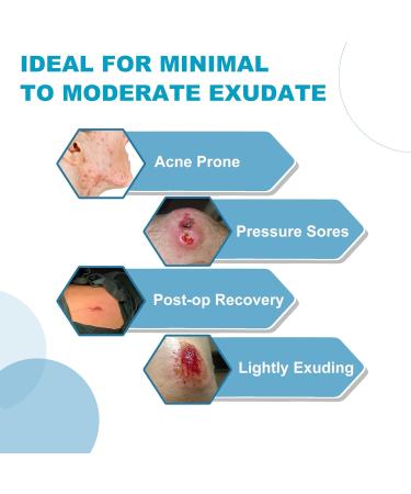 Buy Pack of 10 Hydrocolloid Adhesive Bandages Sterile 4x4 Hydrogel Wound Dressing for Fast Healing of Bedsores Surgical Wounds and Acne Prone Skin International Shipping Available - Buy Online on GoSupps.com