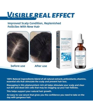 Scalp and Hair Strengthening Oil | Oil for Hair Growth & Healthy Scalp | Hair Growth Oil | Hair Premium Hair Growth and Scalp Oil for Strong and Healthy Hair for Healthy and Shinier Hair - Buy Online on GoSupps.com