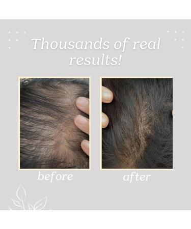 Buy START NATURALS Batana Oil - 100% Pure & Natural Hair Strengthening Oil from Honduras | Promotes Hair Wellness for Men & Women - Buy Online on GoSupps.com