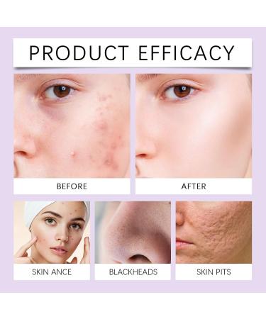 Nettoyant Visage L'aloe Vera - Doux Hydratant Et Mousse Onctueuse | Hydratant Non Raffermissant Contr le Le S bum(1PCS) 1 g (Lot de 1) - Buy Online on GoSupps.com