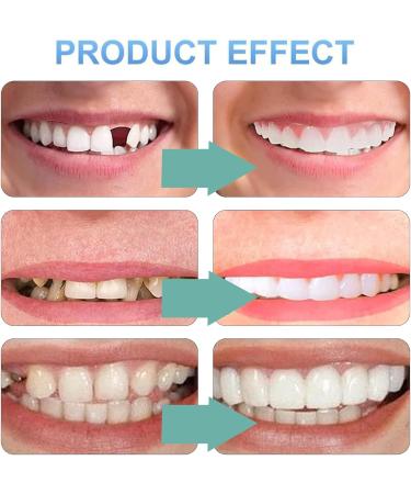 Frenzify 2 Pairs Instant Perfect Smile Dentures Fake Teeth Veneer Top Bottom Whitening Dentures Cosmetic Veneers for Women Men Natural and Comfortable - Buy Online on GoSupps.com