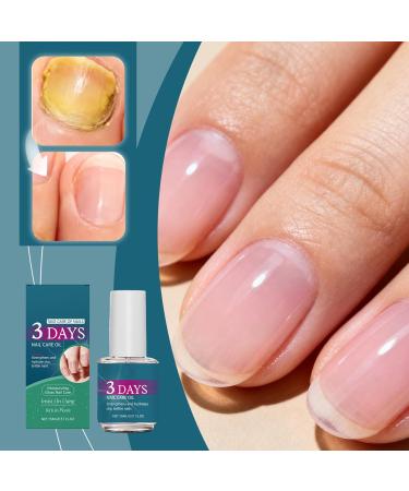 Huile de soin des ongles 3 jours fortifiante et stimulante pour la pousse hydratante et nourrissante pour les cuticules adapt e aux ongles mous et fragiles soin hydratant intense pour (1PCS) - Buy Online on GoSupps.com