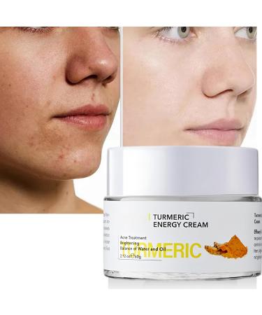  Hinapan Turmeric Face Cream Anti-Aging & Dark Spot Turmeric Face Cream Revitalizing Day Cream for Even and Brightening Skin 60g - Buy Online on GoSupps.com