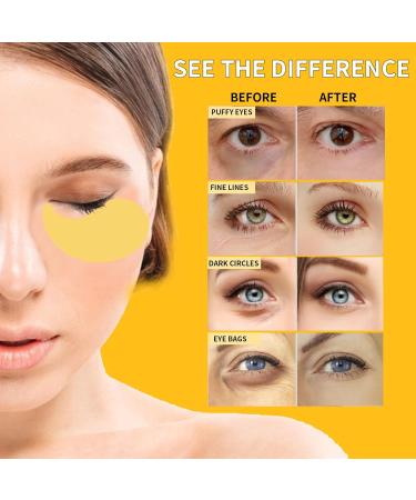 24K Gold Eye Masks for Dark Circles & Puffiness - 70PCS Under Eye Patches with Caffeine Hyaluronic Acid & Peptides for Eye Bags Treatment - Premium Skincare - Buy Online on GoSupps.com