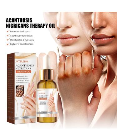 Fulvtuy JAYSUING Acanthosis Nigricans Therapy Oil - Reduces Dark Spots, Soothes Skin - 5 Pack - Buy Online on GoSupps.com