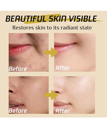 Turmeric & Kojic Acid Face Exfoliator Pad - Cleansing Pads - Gentle Face Toner Pads - Brighting Skin Exfoliating Pads - Exfoliating Face Pads Fade Acne Nourish Face Care - Buy Online on GoSupps.com