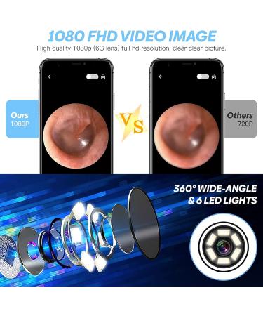 Wireless Smart Ear Wax Removal Tool for iPhone, iPad & Android - COSYLIFE Ear Cleaner Endoscope with 6 LED Lights and Camera - Buy Online on GoSupps.com