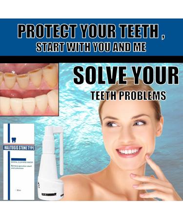 Mouth Shower Test Winner | Calculus-Free Deep Cleaning Foam & Stain Removal Tooth Spray - 30ml White - Buy Online on GoSupps.com