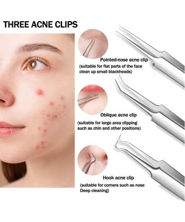 Pimple Popper Tool Kit - 15PCS Blackhead Remover & Extraction Tools for Estheticians - Buy Online on GoSupps.com