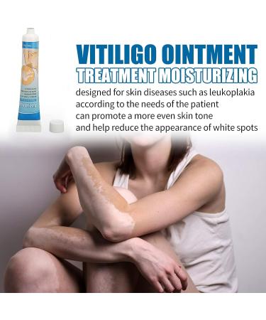 Dauerhaft Vitiligo Treatment Ointment - Herbal Extract Vitiligo Cream for Skin Pigmentation - 0.7oz - Buy Online on GoSupps.com