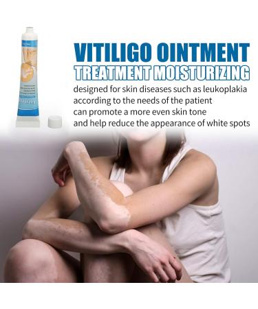 Vitiligo Repair Cream - Herbal Extract Treatment Ointment for Skin Pigmentation 0.7oz - Buy Online on GoSupps.com
