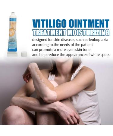 0.7oz Vitiligo Treatment Ointment - Herbal Extract for White Spots & Skin Pigmentation - Buy Online on GoSupps.com