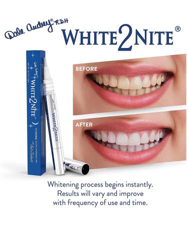 White2nite Teeth Whitening Pen - Enamel Safe Gel for Extreme Natural Whitening | Dentist Recommended | Instant Results - Peppermint, Strawberry, Chocolate Mint - Buy Online on GoSupps.com