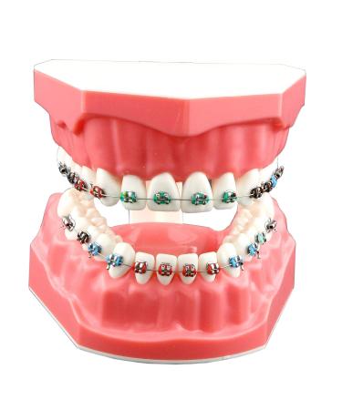 Dental Orthodontic Model Teeth Treatment Model with Metal Bracket Archs Tubes Ligature Ties for Teaching Studying Standard Size